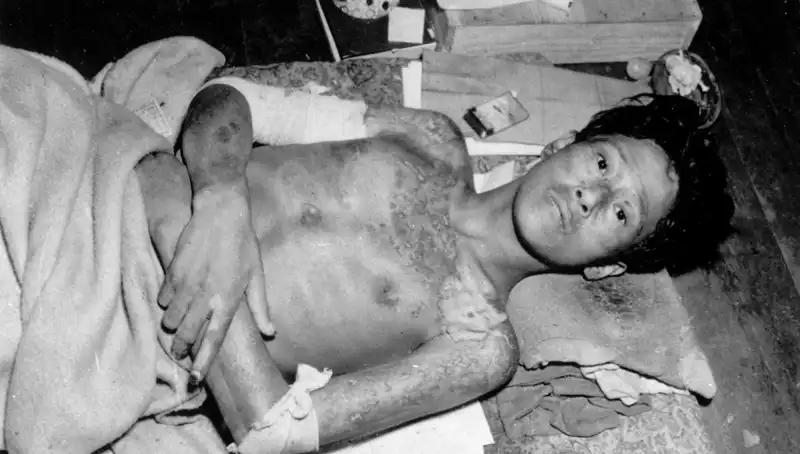80 Yıl Sonra Nagasaki'den Nükleer Tehlikeye Dikkat Çekiliyor