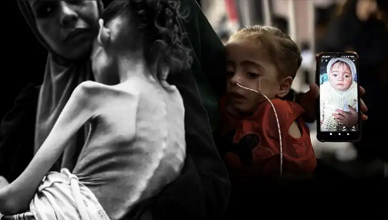 Küçük Meryem'in Açlık Savaşında Düşen Kilosu Hayatını Tehdit Ediyor