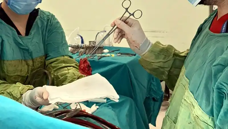 Kalp Kapağı Çürüyen Hastaya Uygulanan 7 Saatlik Ameliyat: Doktorlardan Mucizevi Başarı